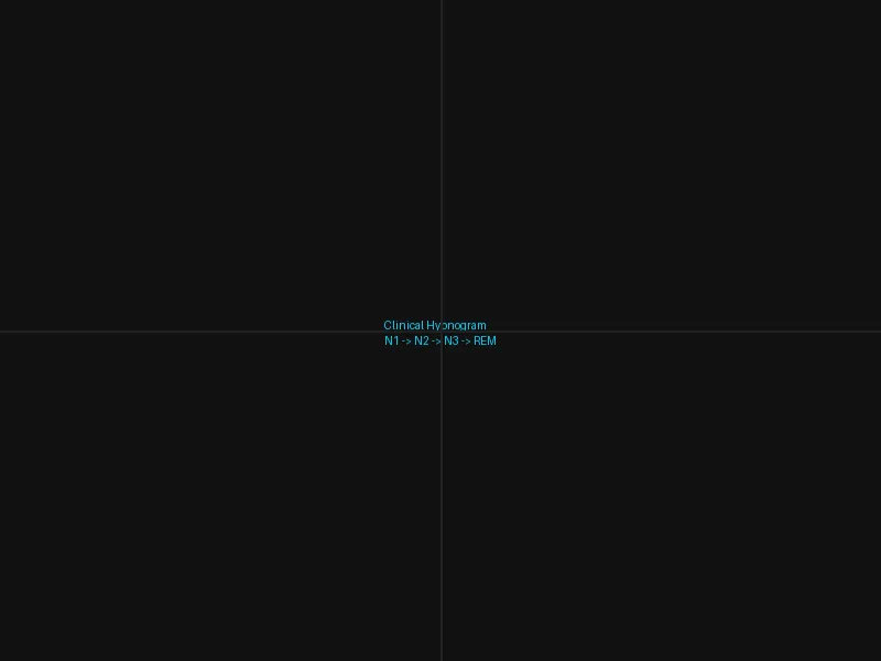 Typical 8-hour hypnogram showing sleep stages